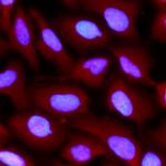 FAK Antibody in Immunocytochemistry (ICC/IF)