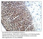 FAK2 Polyclonal Antibody