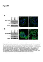 Phospho-FAK (Tyr397) Antibody in Western Blot, Immunocytochemistry (WB, ICC/IF)