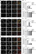 Phospho-FAK (Tyr397) Antibody in Immunocytochemistry (ICC/IF)