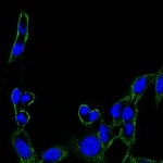 FAK Monoclonal Antibody (10H7)