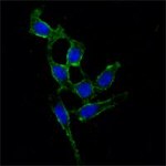FAK Monoclonal Antibody (10H7E9)