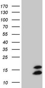 FAM104B Antibody in Western Blot (WB)