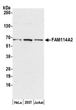 FAM114A2 Polyclonal Antibody