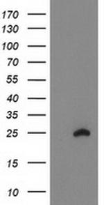 FAM119A Antibody in Western Blot (WB)