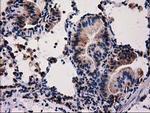 FAM127C Antibody in Immunohistochemistry (Paraffin) (IHC (P))