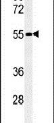 FAM151A Antibody in Western Blot (WB)
