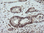 FAM164A Antibody in Immunohistochemistry (Paraffin) (IHC (P))