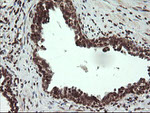 FAM164A Antibody in Immunohistochemistry (Paraffin) (IHC (P))