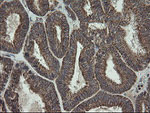 FAM164A Antibody in Immunohistochemistry (Paraffin) (IHC (P))
