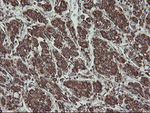 FAM164A Antibody in Immunohistochemistry (Paraffin) (IHC (P))
