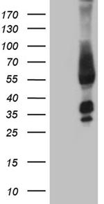 FAM170A Antibody in Western Blot (WB)