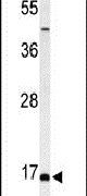 FAM44B Antibody in Western Blot (WB)