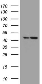 FAM54A Antibody in Western Blot (WB)