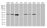 FAM54A Antibody in Western Blot (WB)