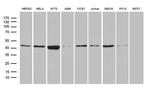 FAM54A Antibody in Western Blot (WB)