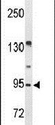 FAM5C Antibody in Western Blot (WB)