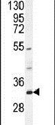 FAM78B Antibody in Western Blot (WB)