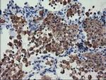 FAM84B Antibody in Immunohistochemistry (Paraffin) (IHC (P))