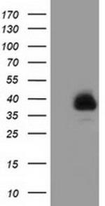 FAM84B Antibody in Western Blot (WB)