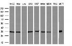 FAM84B Antibody in Western Blot (WB)