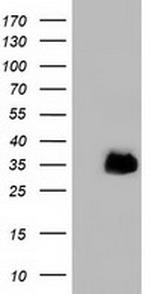 FAM84B Antibody in Western Blot (WB)