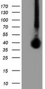 FAM84B Antibody in Western Blot (WB)