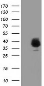 FAM84B Antibody in Western Blot (WB)