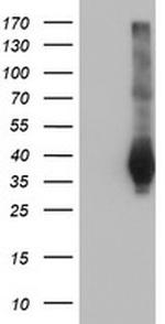FAM84B Antibody in Western Blot (WB)