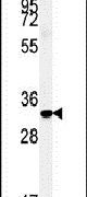 FAM92A1 Antibody in Western Blot (WB)