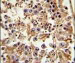 FANCC Antibody in Immunohistochemistry (IHC)