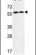 FANCC Antibody in Western Blot (WB)