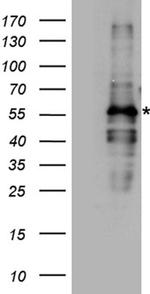 FANCE Antibody in Western Blot (WB)