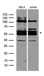 FANCE Antibody in Western Blot (WB)