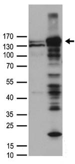 FANCI Antibody in Western Blot (WB)