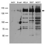 FANCI Antibody in Western Blot (WB)