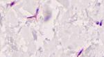 FAP Antibody in Immunohistochemistry (Paraffin) (IHC (P))