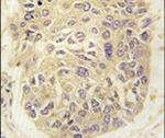 FARSA Antibody in Immunohistochemistry (IHC)