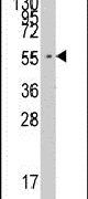 FARSA Antibody in Western Blot (WB)