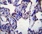 FASN Antibody in Immunohistochemistry (IHC)