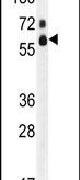 FASTK Antibody in Western Blot (WB)