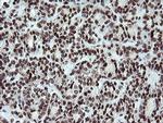 FATE1 Antibody in Immunohistochemistry (Paraffin) (IHC (P))