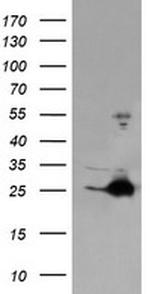FATE1 Antibody in Western Blot (WB)
