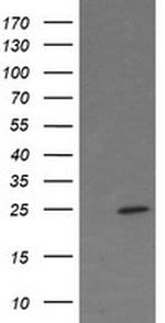 FATE1 Antibody in Western Blot (WB)