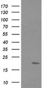 FATE1 Antibody in Western Blot (WB)