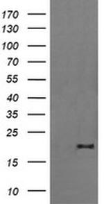 FATE1 Antibody in Western Blot (WB)