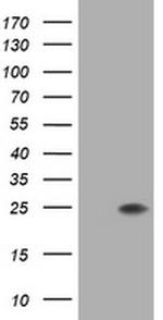 FATE1 Antibody in Western Blot (WB)