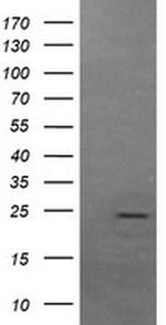 FATE1 Antibody in Western Blot (WB)