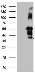 FBLIM1 Antibody in Western Blot (WB)