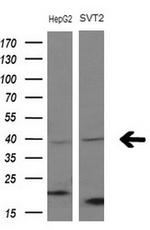 FBLIM1 Antibody in Western Blot (WB)